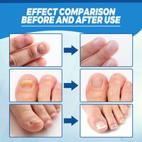 Color Block Foot Care Simple Style Personal Care main image 4