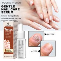 Lettre Solution De Soin Des Ongles Soin Des Pieds Style Simple Soins Personnels sku image 1