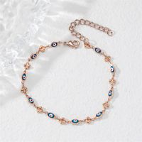 Vacation Eye Alloy Women's Anklet main image 1